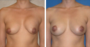 Before & After Photos